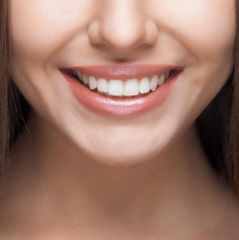 blog - Cheadle Hulme Dental