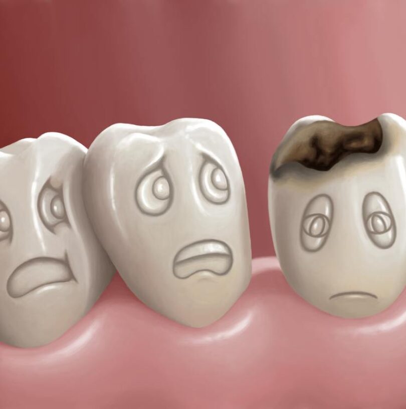 blog - Cheadle Hulme Dental