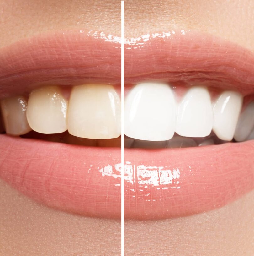 blog - Cheadle Hulme Dental
