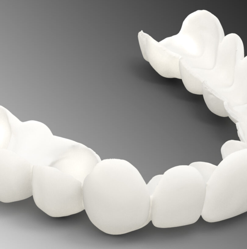 blog - Cheadle Hulme Dental