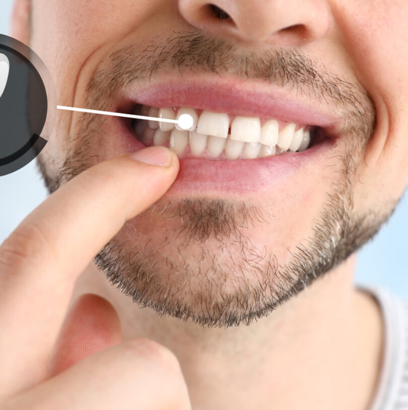 blog - Cheadle Hulme Dental