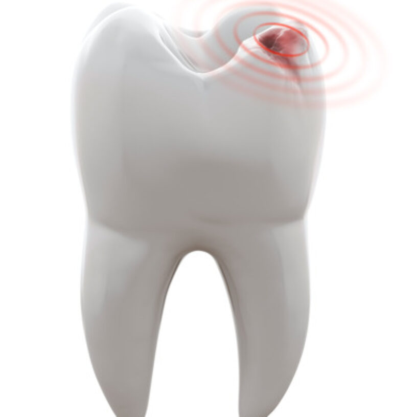 blog - Cheadle Hulme Dental