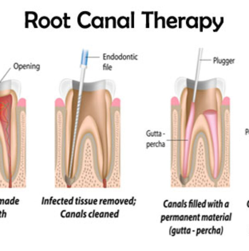 blog - Cheadle Hulme Dental