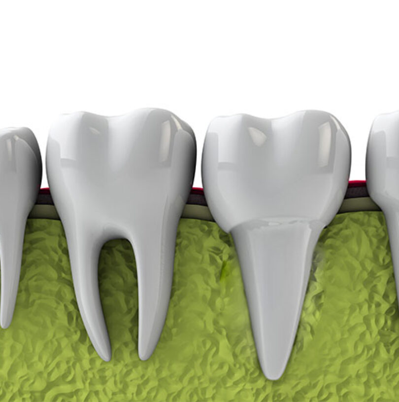 blog - Cheadle Hulme Dental