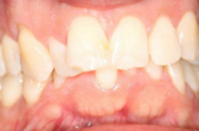 Before - Cheadle Hulme Dental