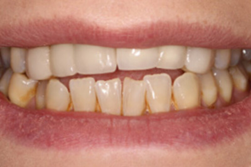 Before - Cheadle Hulme Dental