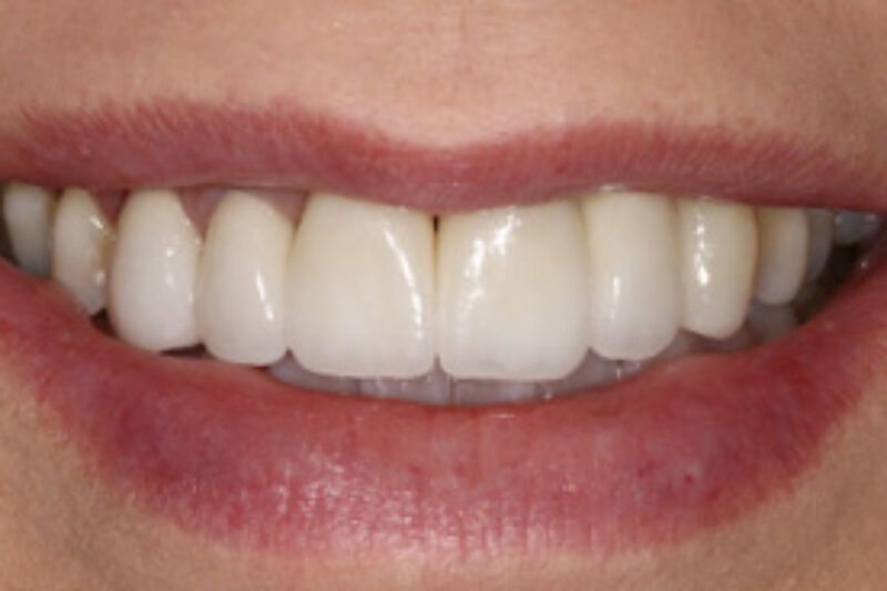 After - Cheadle Hulme Dental