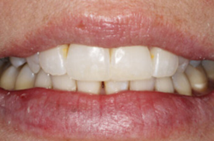 After - Cheadle Hulme Dental