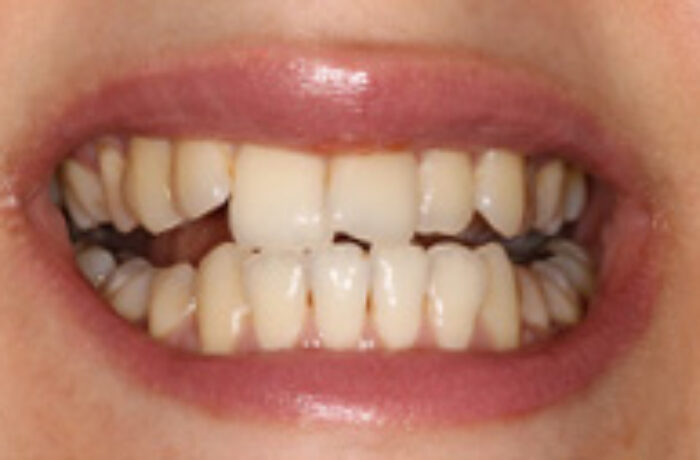 Before - Cheadle Hulme Dental