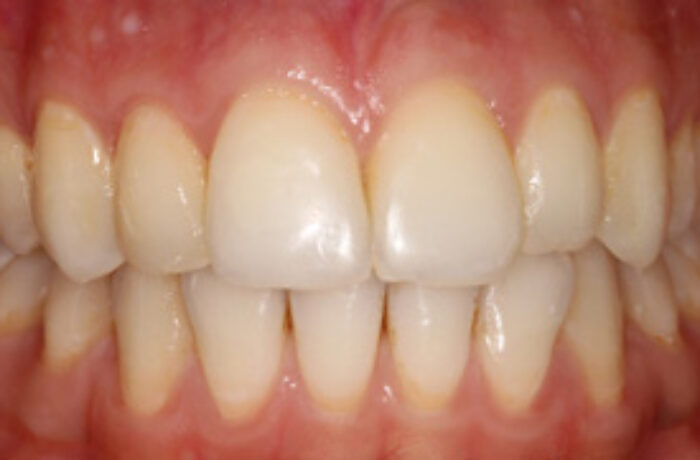 After - Cheadle Hulme Dental