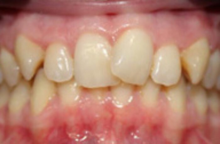 Before - Cheadle Hulme Dental