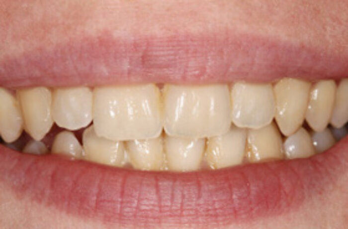 After - Cheadle Hulme Dental