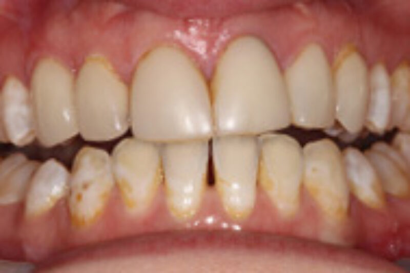 Before - Cheadle Hulme Dental