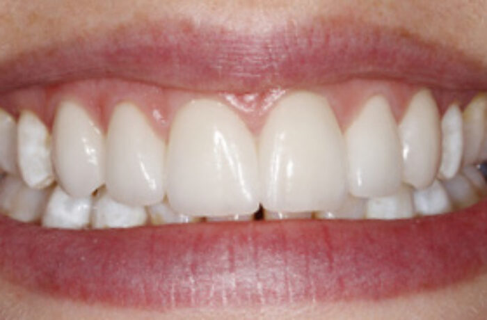 After - Cheadle Hulme Dental