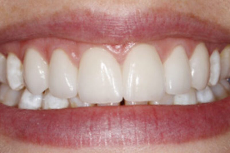 After - Cheadle Hulme Dental