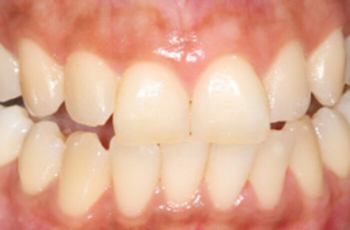 Before - Cheadle Hulme Dental