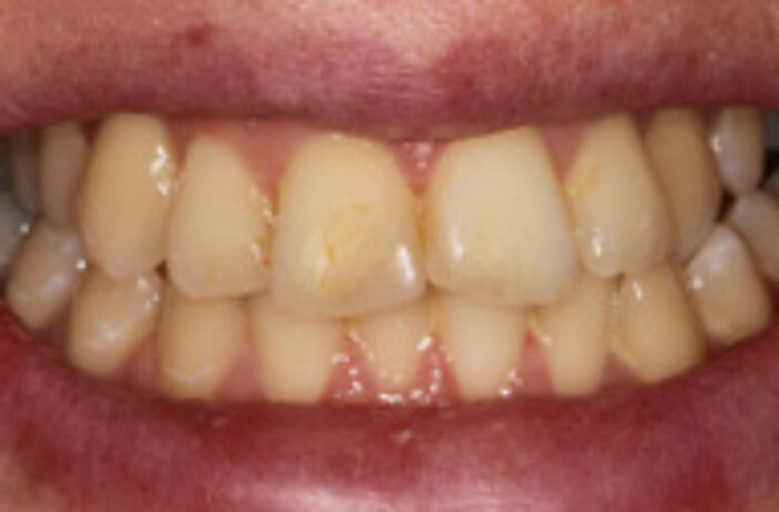 Before - Cheadle Hulme Dental