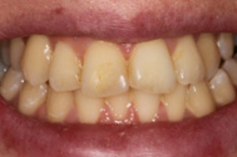 Before - Cheadle Hulme Dental