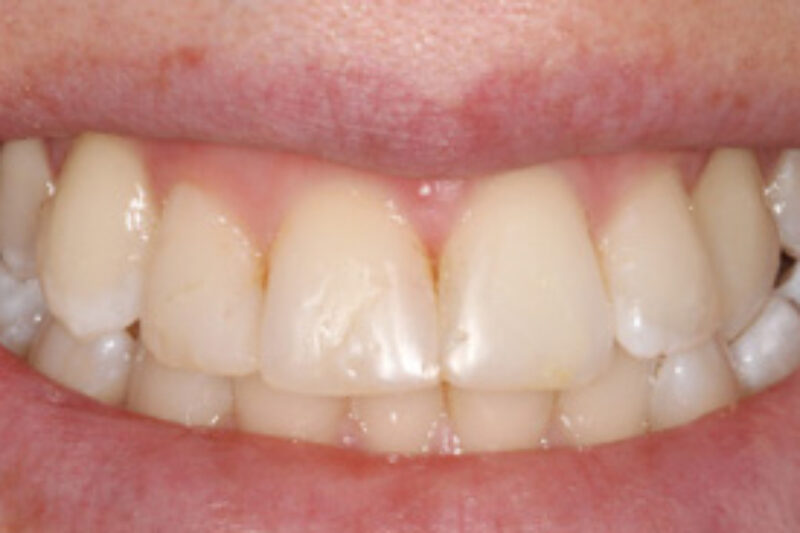 After - Cheadle Hulme Dental