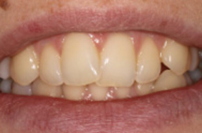 Before - Cheadle Hulme Dental