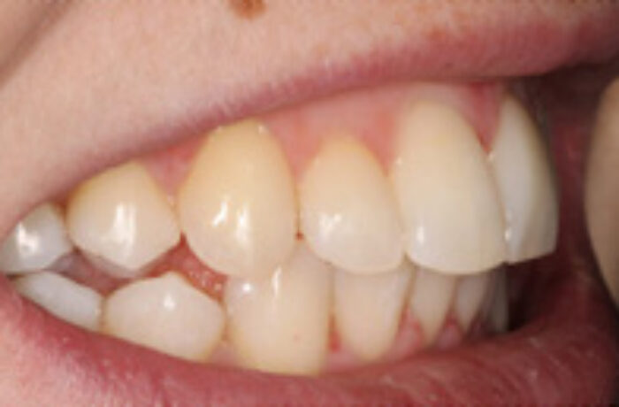 After - Cheadle Hulme Dental