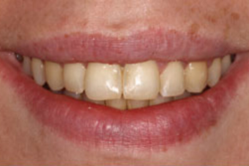 After - Cheadle Hulme Dental