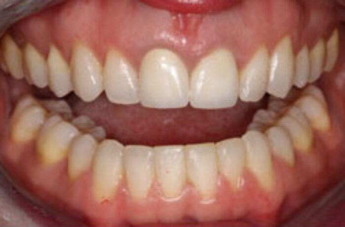 After - Cheadle Hulme Dental