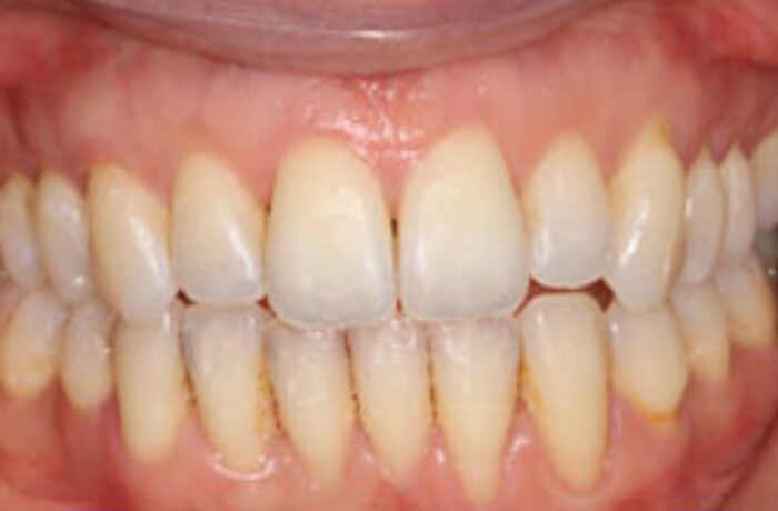 After - Cheadle Hulme Dental
