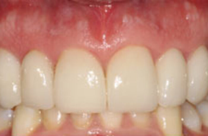 After - Cheadle Hulme Dental