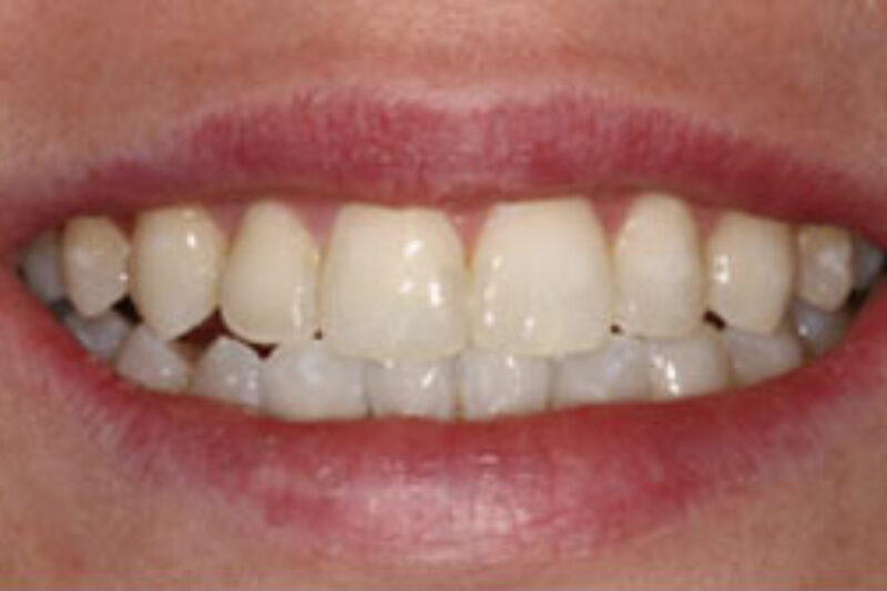 After - Cheadle Hulme Dental
