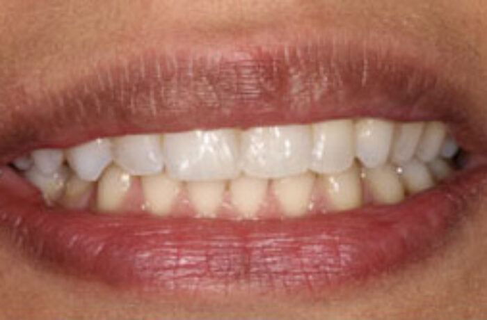 After - Cheadle Hulme Dental