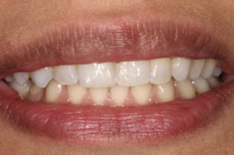 After - Cheadle Hulme Dental