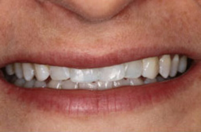 After - Cheadle Hulme Dental