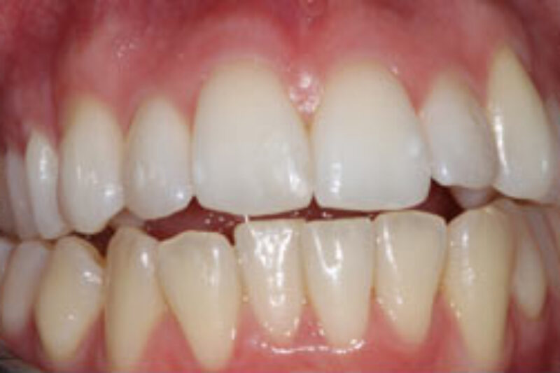 After - Cheadle Hulme Dental