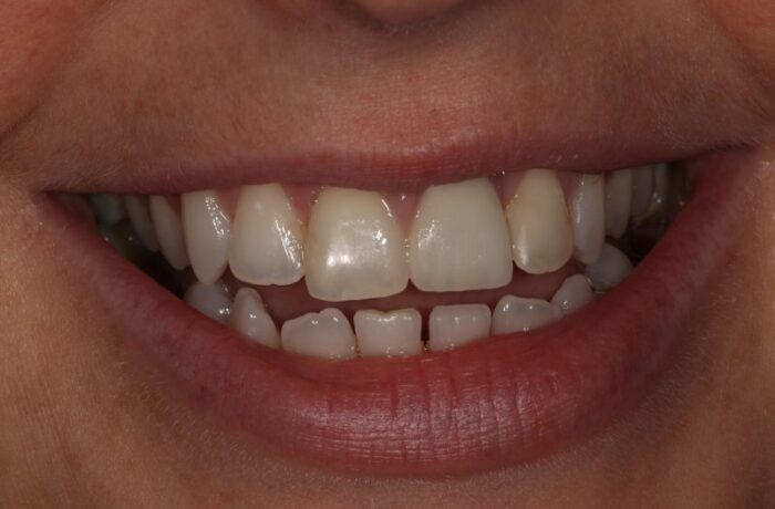 After - Cheadle Hulme Dental