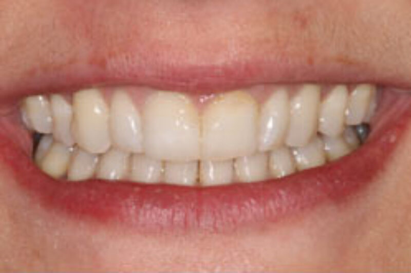 After - Cheadle Hulme Dental