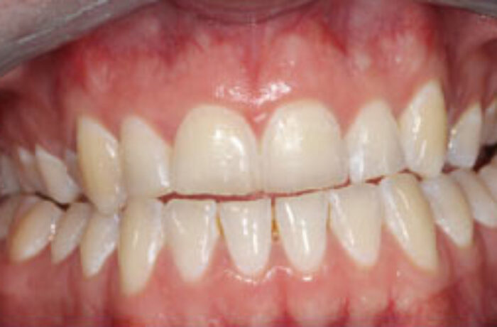 After - Cheadle Hulme Dental