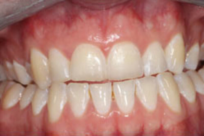 After - Cheadle Hulme Dental