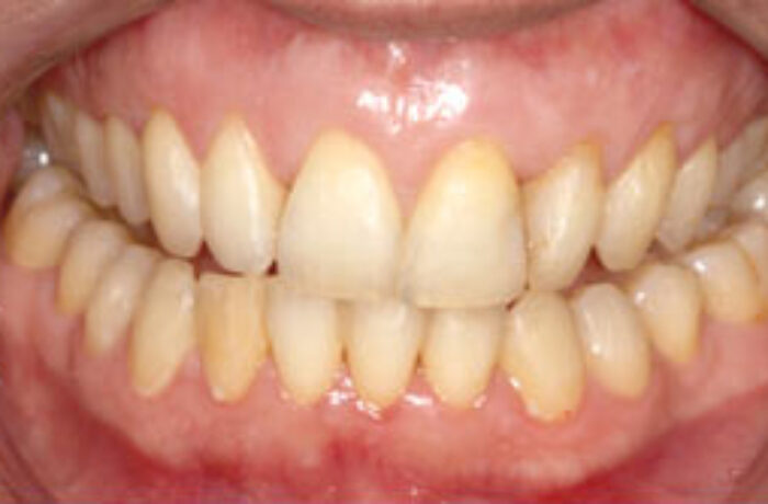 After - Cheadle Hulme Dental
