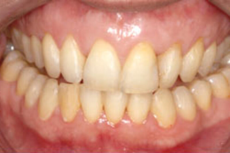 After - Cheadle Hulme Dental