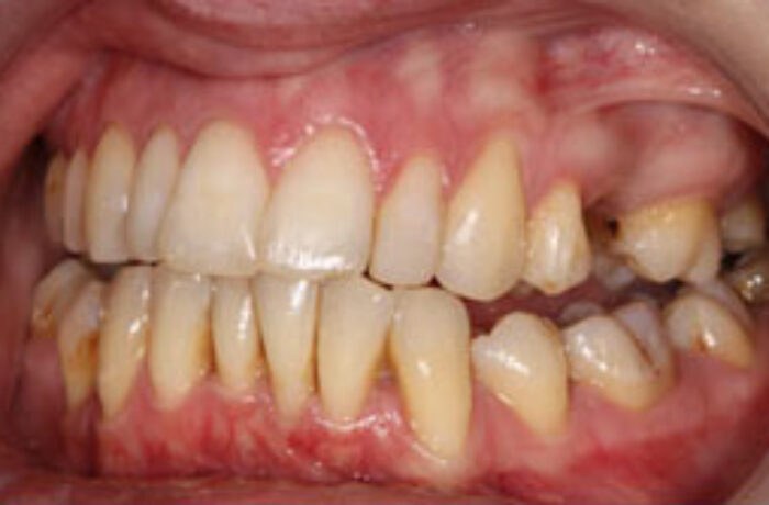 After - Cheadle Hulme Dental