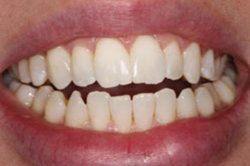 After - Cheadle Hulme Dental