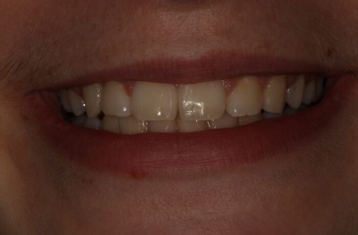 After - Cheadle Hulme Dental