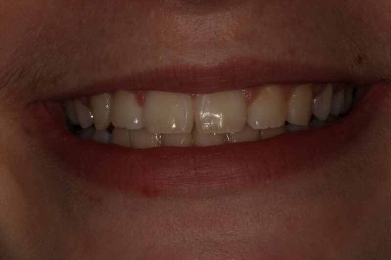 After - Cheadle Hulme Dental