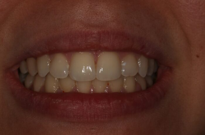 After - Cheadle Hulme Dental