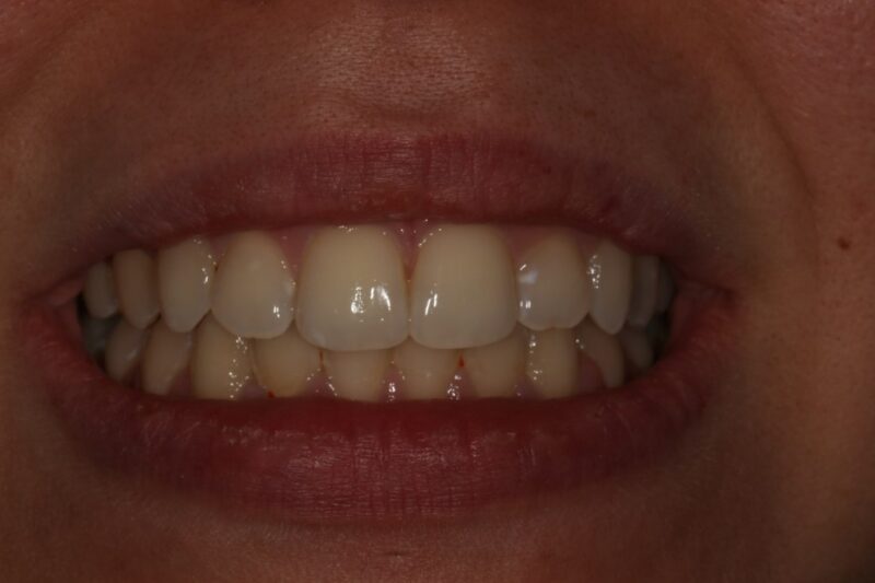 After - Cheadle Hulme Dental