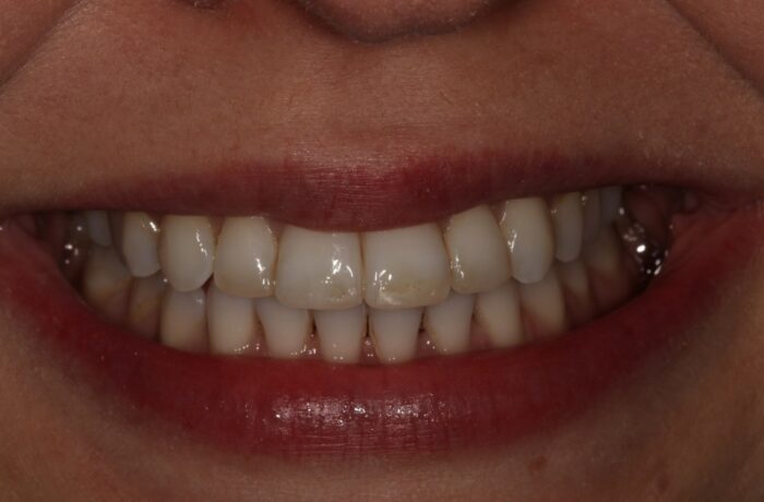 After - Cheadle Hulme Dental