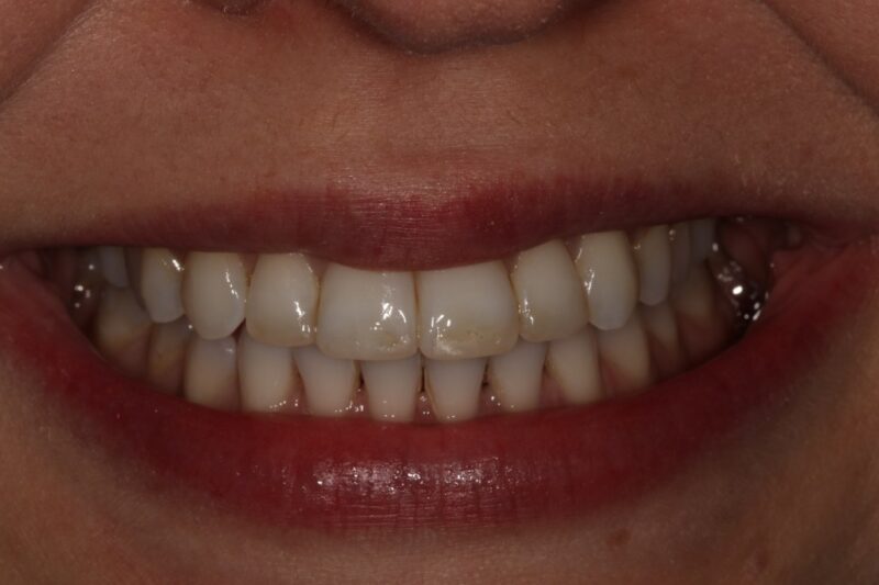 After - Cheadle Hulme Dental