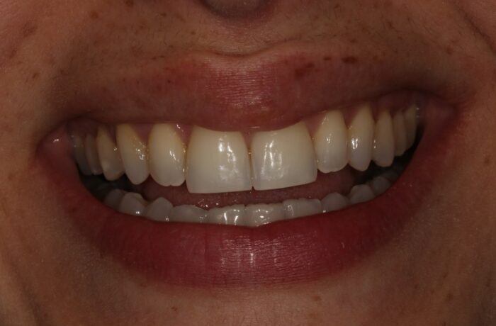 After - Cheadle Hulme Dental
