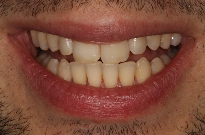 After - Cheadle Hulme Dental